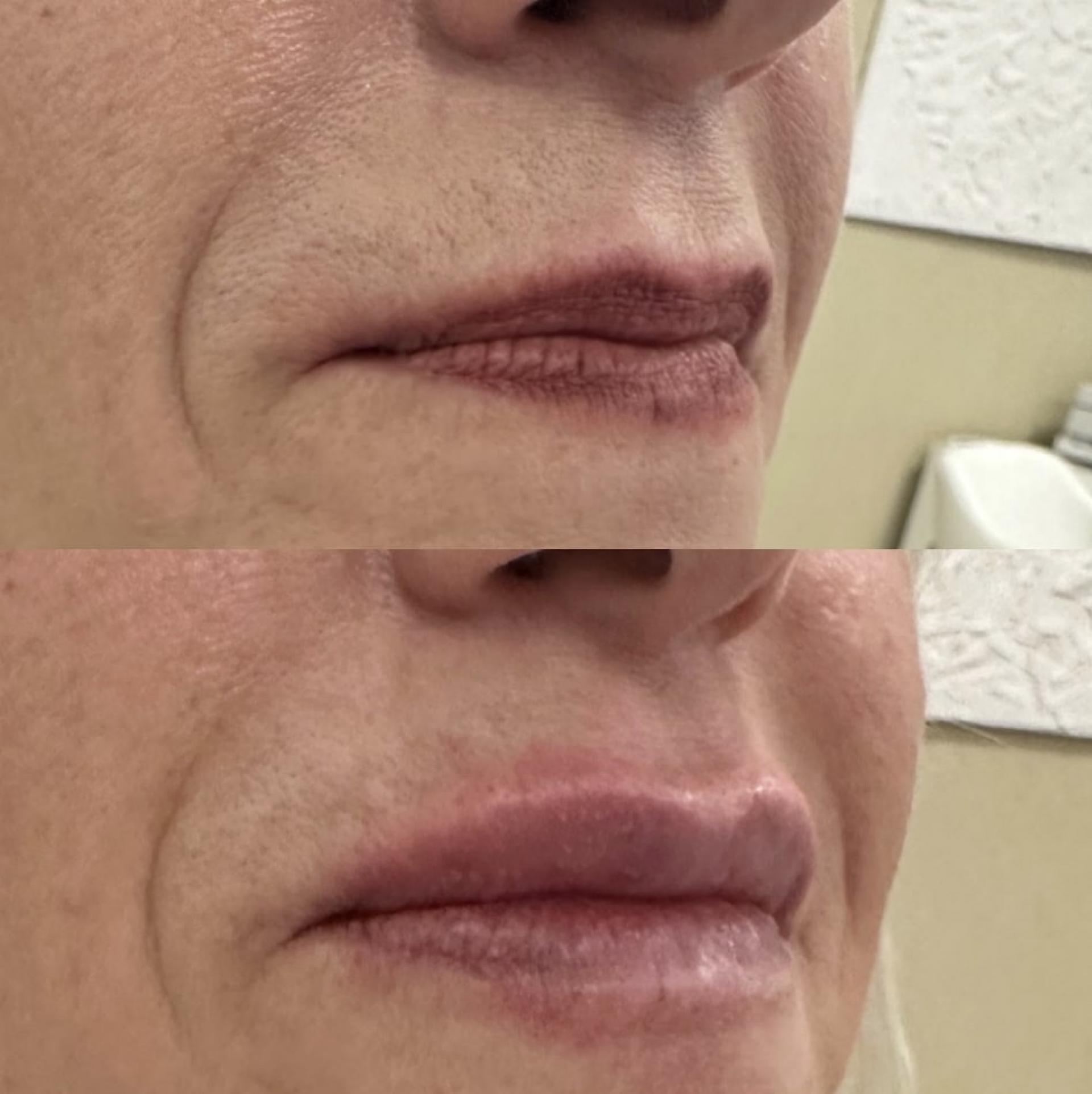 Client's transformation